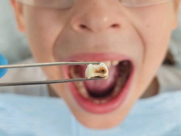 Best Pediatric Emergency Dentist in Hartford, SD
